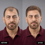 Men's Hair System – before and after, shade M5, 8*10 انش