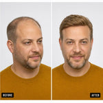 Men's Hair System – before and after, shade M18, 8*10 انش