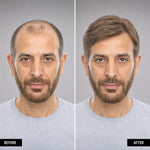 Men's Hair System – before and after, shade M6, 8*10 انش