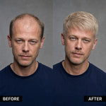 Men's Hair System – before and after, shade M22, 8*10 انش