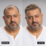 Men's Hair System – before and after, shade M7ASH, 8*10 انش