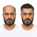 Duo Mono Hair Wig For Men