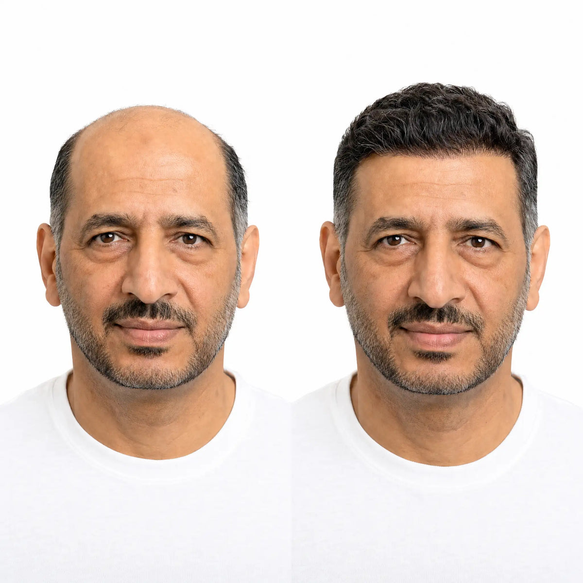 باروكة شعر طبيعي للرجال المونو
