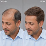 Men's Hair System – before and after, side profile, shade M4, 8*10 انش