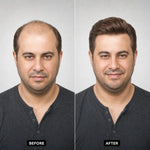 Men's Hair System – before and after, front view, shade M4